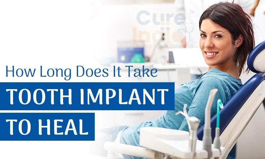 How long does it take tooth implant to heal?